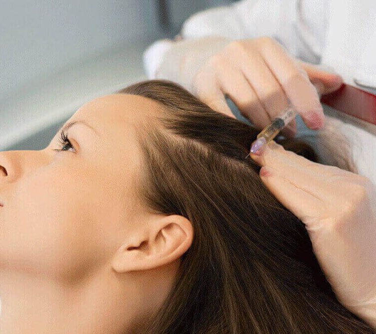 Was ist Haarmesotherapie?