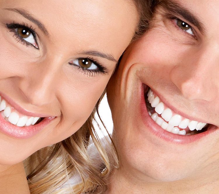 Hollywood Smile Advantages