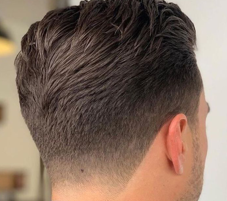 Cos’è il trapianto di capelli 360 Vertex?