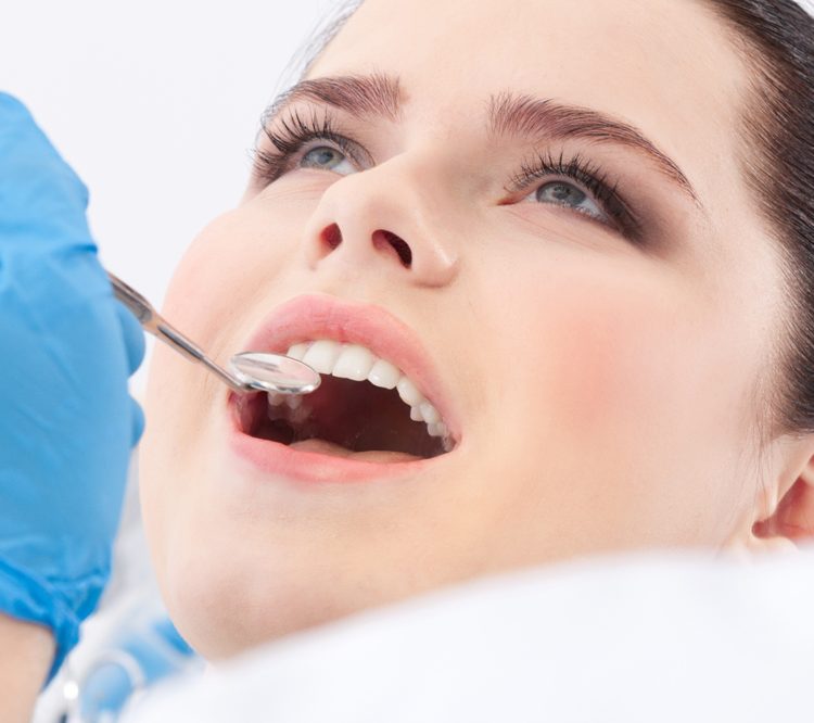 Vantaggi dell'impiallacciatura in porcellana