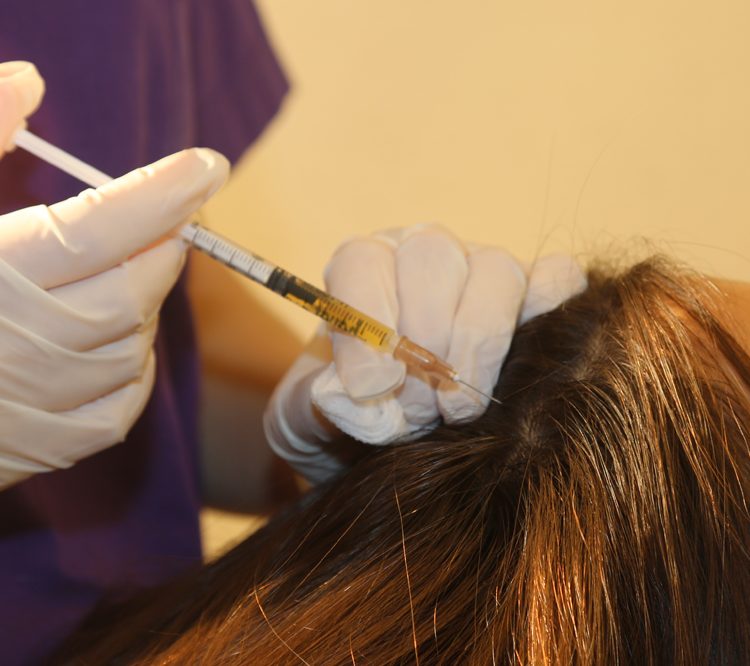 Kök Hücre Terapisi Nedir?