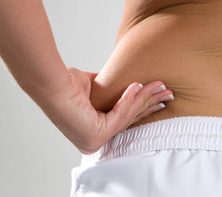 Liposuction Nedir?
